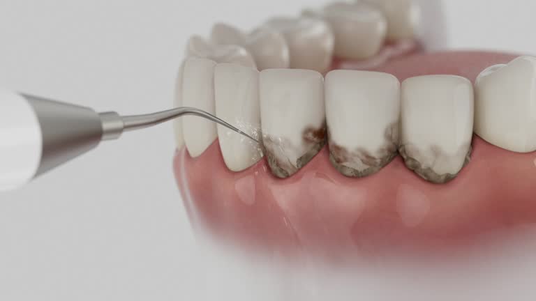 Trusted Dental Implants service in Steger, IL - Dentist Open Now